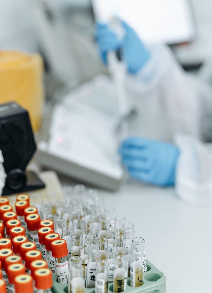 empty blood samples in a laboratory